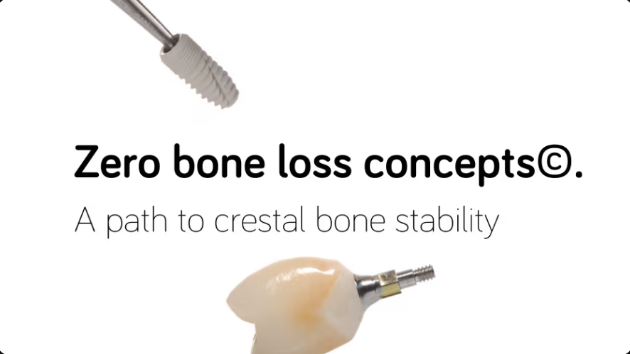 Zero Bone Loss Dental Implants